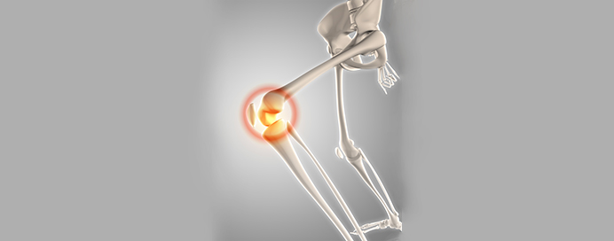 Calcium Disorders