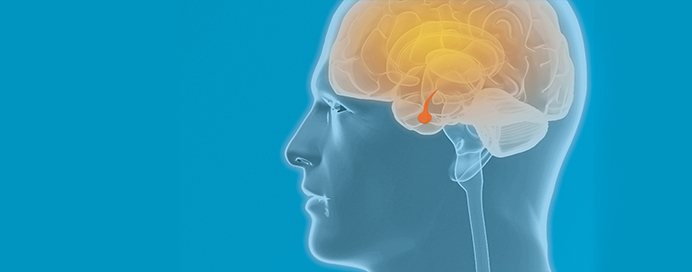 Pituitary Disorders